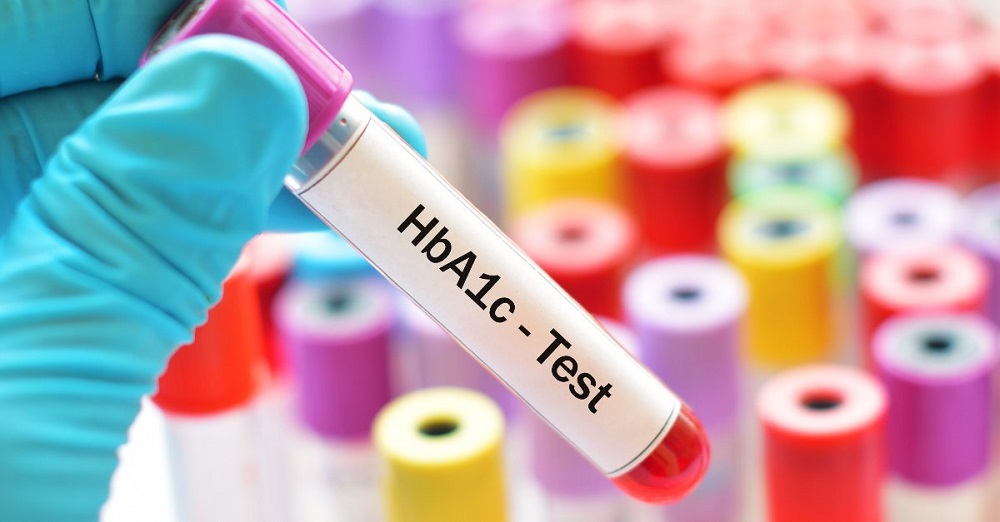Diabetes - what is HbA1c and how often should you check it?