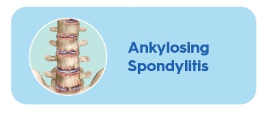 Ankylosing Spondylitis - Articles | Dis-Chem