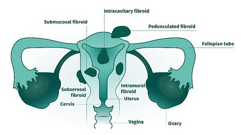 Plutos Group Africa - What Are the Most Fertile Days? A woman is most  fertile while ovulating. The fertile window of a woman depends on the  length of her menstrual cycle, which